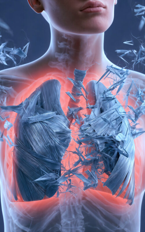 Illustration 3D du buste d'une personne révélant des poumons enflammés et brisés.